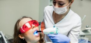 اسعار تبييض الاسنان بالليزر في تركيا