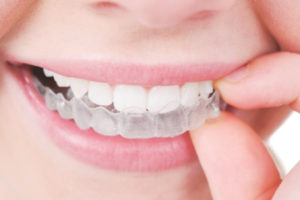 انواع علاج الاسنان
