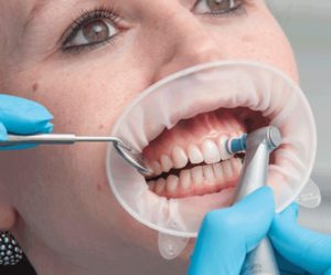 أفضل مستشفى زراعة الأسنان في تركيا