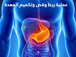 افضل اطباء التكميم في تركيا